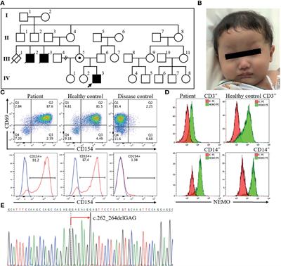 Case Report: Analysis of Preserved Umbilical Cord Clarified X-Linked Anhidrotic Ectodermal Dysplasia With Immunodeficiency in Deceased, Undiagnosed Uncles